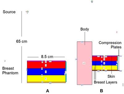 Utilization of three-layers heterogeneous mammographic phantom through MCNPX code for breast and chest radiation dose levels at different diagnostic X-ray energies: A Monte Carlo simulation study